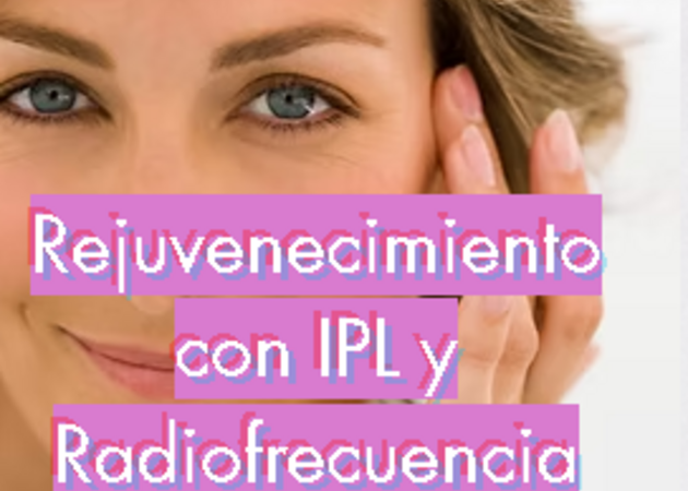 Image gallery Lola Cé 1