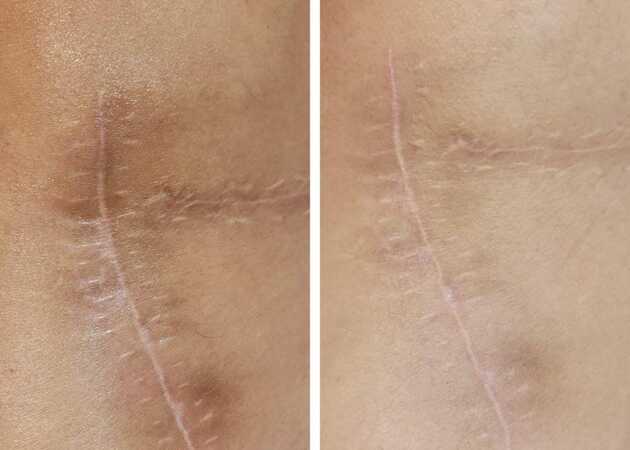 Galería de imágenes Hidden Beauty 1